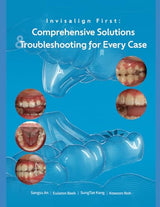 Invisalign First Comprehensive solutions and Trouble shooting for every case: A Step-by-Step Guide to Mixed-Dentition Clear Aligners, Digital Planning and Clinical Troubleshooting Invisalign first