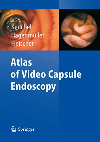 Atlas of Video Capsule Endoscopy: 1st Edition