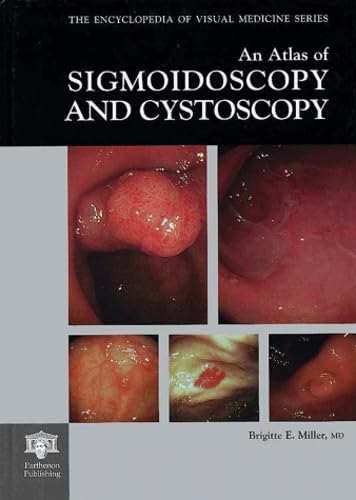 An Atlas of Sigmoidoscopy and Cystoscopy (Encyclopedia of Visual Medicine Series)