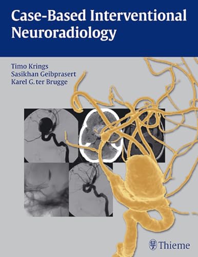 Case-Based Interventional Neuroradiology: 1st Edition
