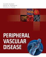Peripheral Vascular Disease:.