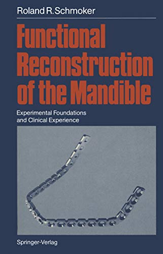 Functional Reconstruction of the Mandible: Experimental Foundations and Clinical Experience: Kindle Edition