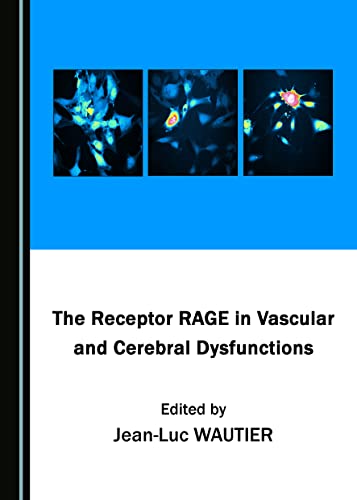 The Receptor RAGE in Vascular and Cerebral Dysfunctions