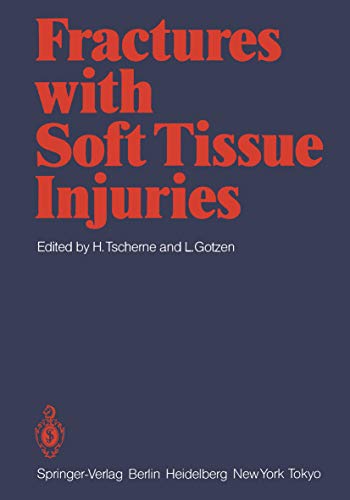 Fractures with Soft Tissue Injuries: 1st Edition, Kindle Edition