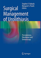 Surgical Management of Urolithiasis: Percutaneous, Shockwave and Ureteroscopy