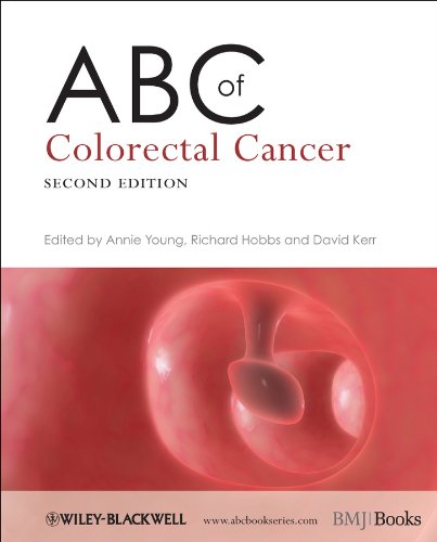 ABC of Colorectal Cancer (ABC Series Book 188): 2nd Edition