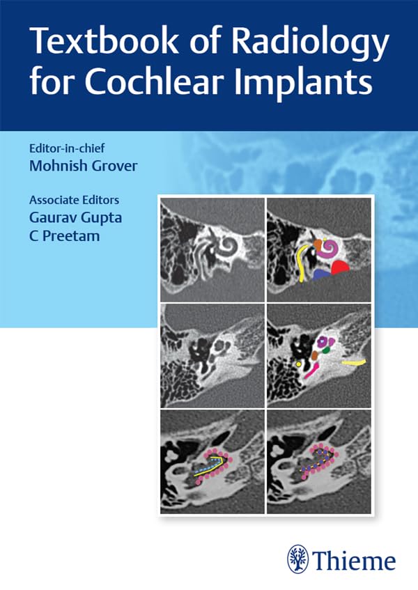 Textbook of Radiology for Cochlear Implants: 1st Edition