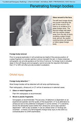 Accident and Emergency Radiology: A Survival Guide