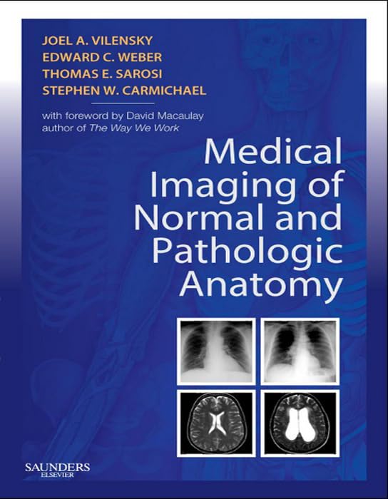 Medical Imaging of Normal and Pathologic Anatomy E-Book: 1st Edition
