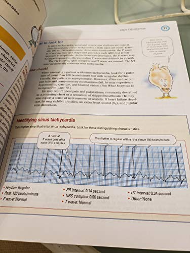 ECG Interpretation Made Incredibly Easy!