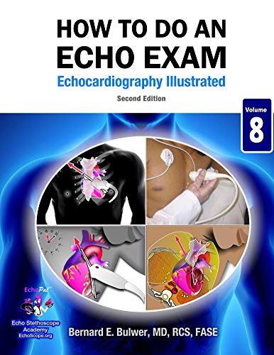 How To Do An Echo Exam: Second Edition (Echocardiography Illustrated Book 8)
