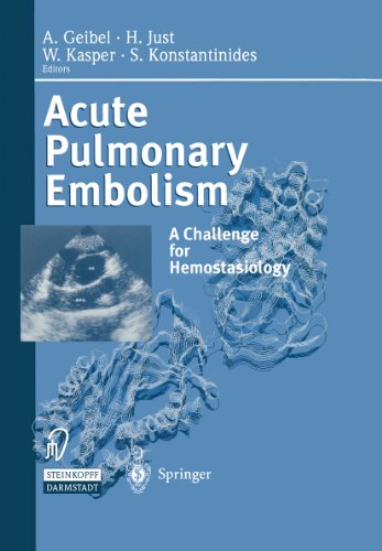 Acute Pulmonary Embolism: A Challenge for Hemostasiology