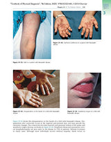 Textbook of Physical Diagnosis: History and Examination With STUDENT CONSULT Online Access