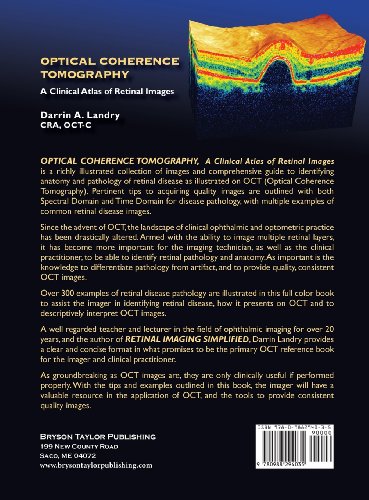 Optical Coherence Tomography