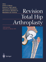 Revision Total Hip Arthroplasty: 1st Edition