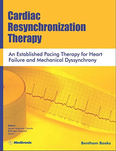 Cardiac Resynchronization Therapy: An Established Pacing Therapy For Heart Failure And Mechanical Dyssynchrony
