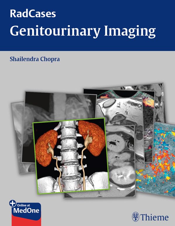 Radcases Genitourinary Imaging (Radcases Plus Q&A): 1st Edition
