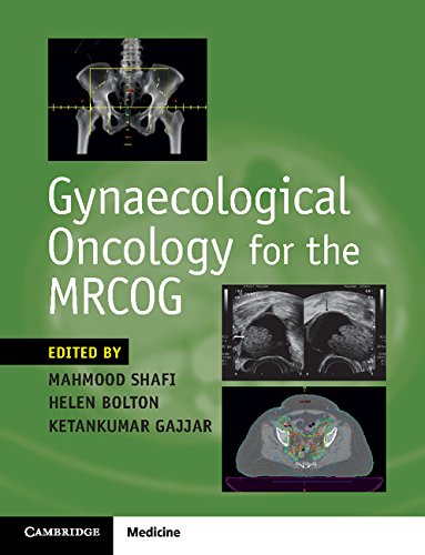 Gynaecological Oncology for the MRCOG: 1st Edition
