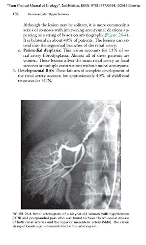 Penn Clinical Manual of Urology: Expert Consult - Online and Print