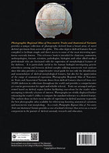 Photographic Regional Atlas of Non-Metric Traits and Anatomical Variants in the Human Skeleton: 1st Edition