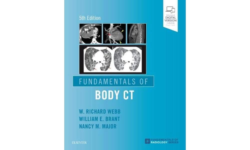 Fundamentals of Body CT (Fundamentals of Radiology): 5th Edition