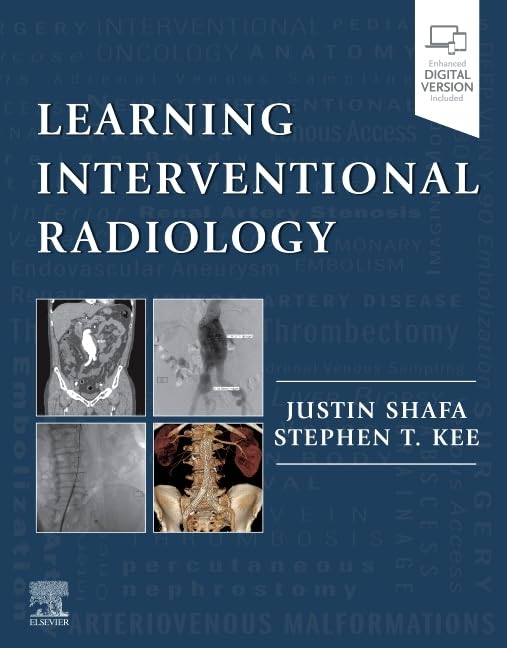 Learning Interventional Radiology: 1st Edition