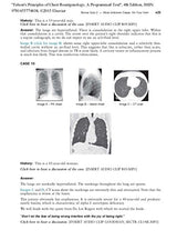 Felson's Principles of Chest Roentgenology, A Programmed Text: 4th Edition