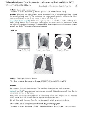 Felson's Principles of Chest Roentgenology, A Programmed Text: 4th Edition