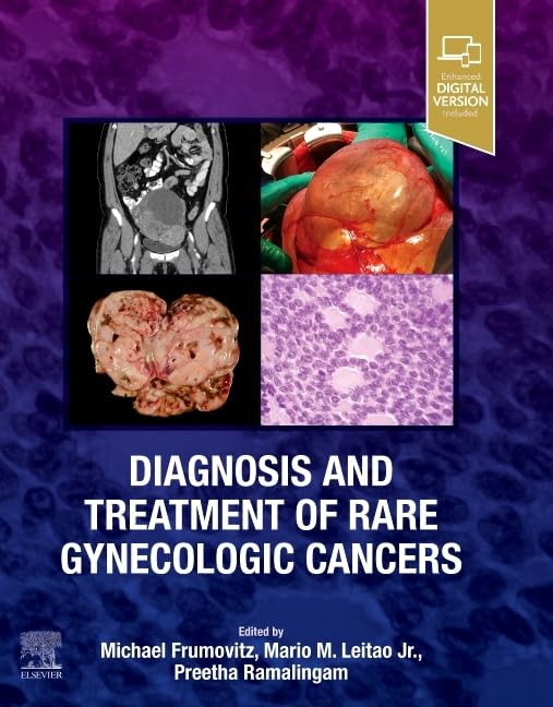 Diagnosis and Treatment of Rare Gynecologic Cancers: 1st Edition