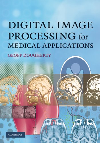 Digital Image Processing for Medical Applications: 1st Edition