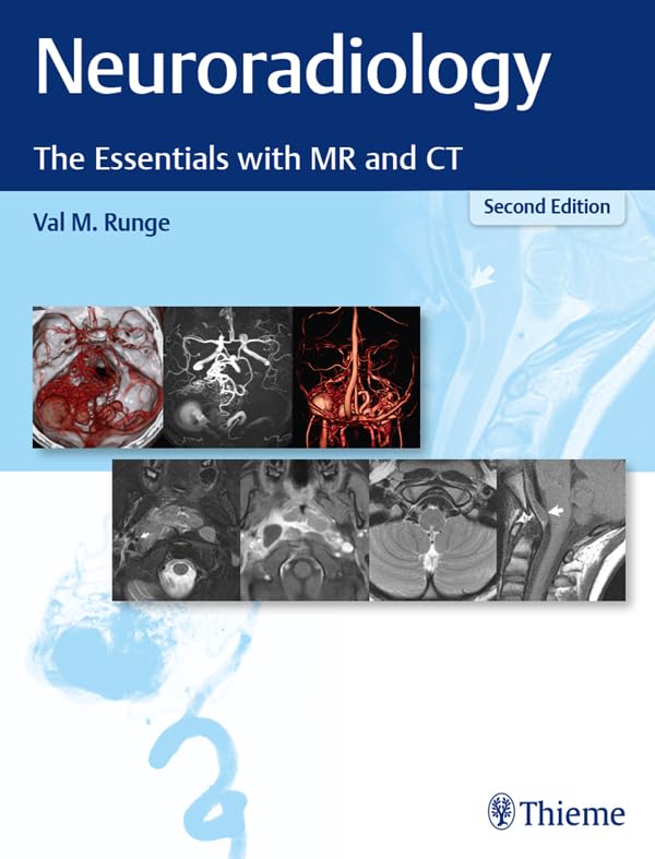 Neuroradiology: The Essentials with MR and CT