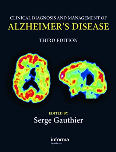 Clinical Diagnosis and Management of Alzheimer's Disease: 3rd Edition
