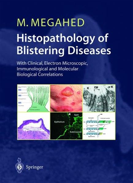 Histopathology of Blistering Diseases: With Clinical, Electron Microscopic, Immunological and Molecular Biology Correlations
