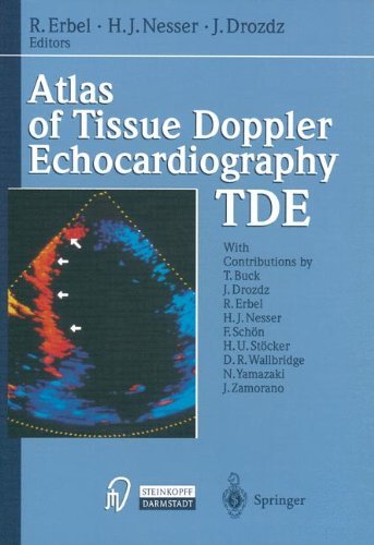 Atlas of Tissue Doppler Echocardiography — TDE: 1st Edition