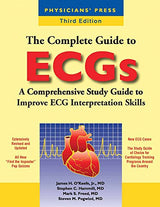 The Complete Guide to ECGs:.