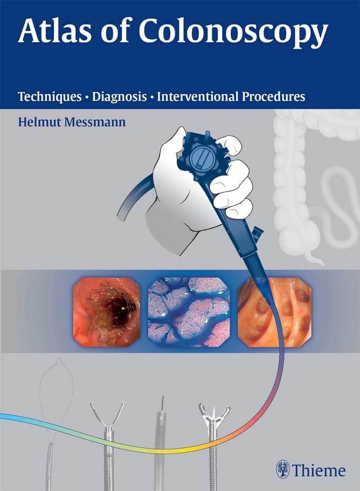 Atlas of Colonoscopy: Techniques - Diagnosis - Interventional Procedures
