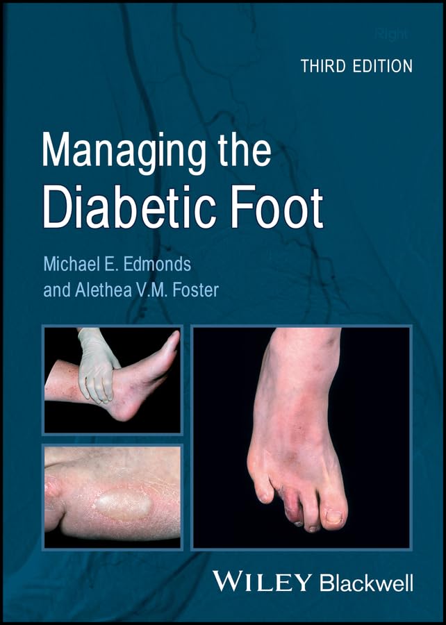 Managing the Diabetic Foot: 3rd Edition
