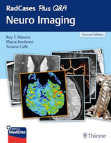 RadCases Plus Q&A Neuro Imaging: 2nd Edition