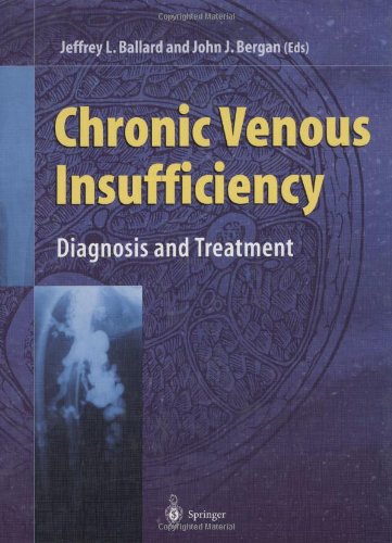 Chronic Venous Insufficiency: Diagnosis and Treatment