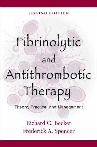 Fibrinolytic and Antithrombotic Therapy: Theory, Practice, and Management