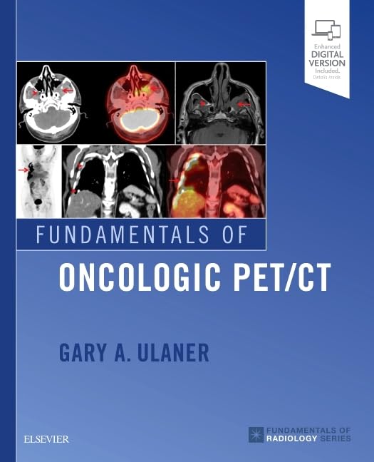 Fundamentals of Oncologic PET/CT (Fundamentals of Radiology): 1st Edition