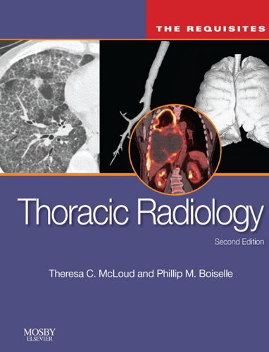 Thoracic Radiology: The Requisites in Radiology)
