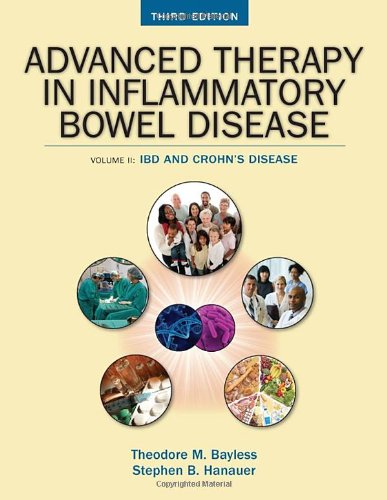 Advanced Therapy of Inflammatory Bowel Disease: IBD and Crohn's Disease