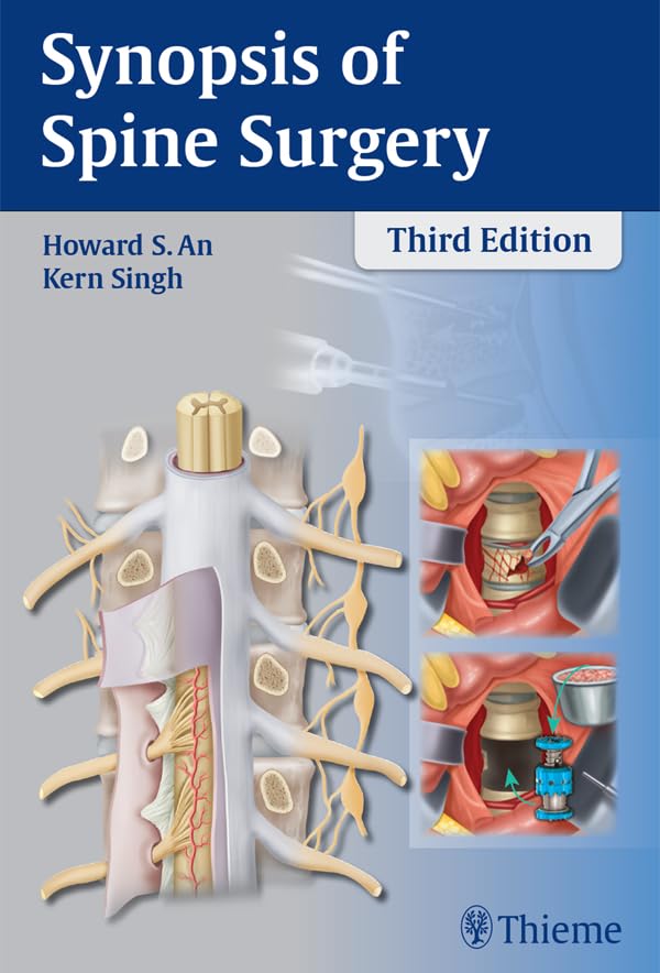 Synopsis of Spine Surgery: Kindle Edition