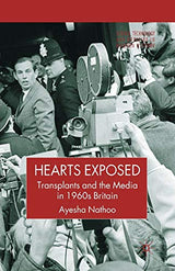 Hearts Exposed: Transplants and the Media in 1960s Britain (Science, Technology and Medicine in Modern History)