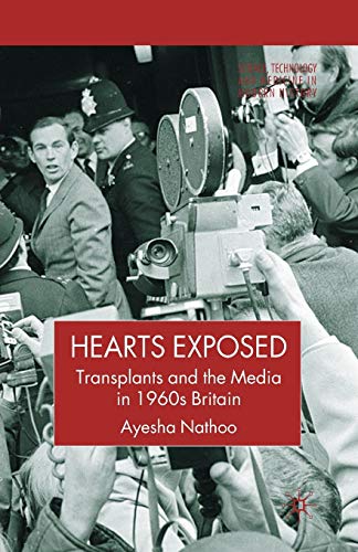 Hearts Exposed: Transplants and the Media in 1960s Britain (Science, Technology and Medicine in Modern History)