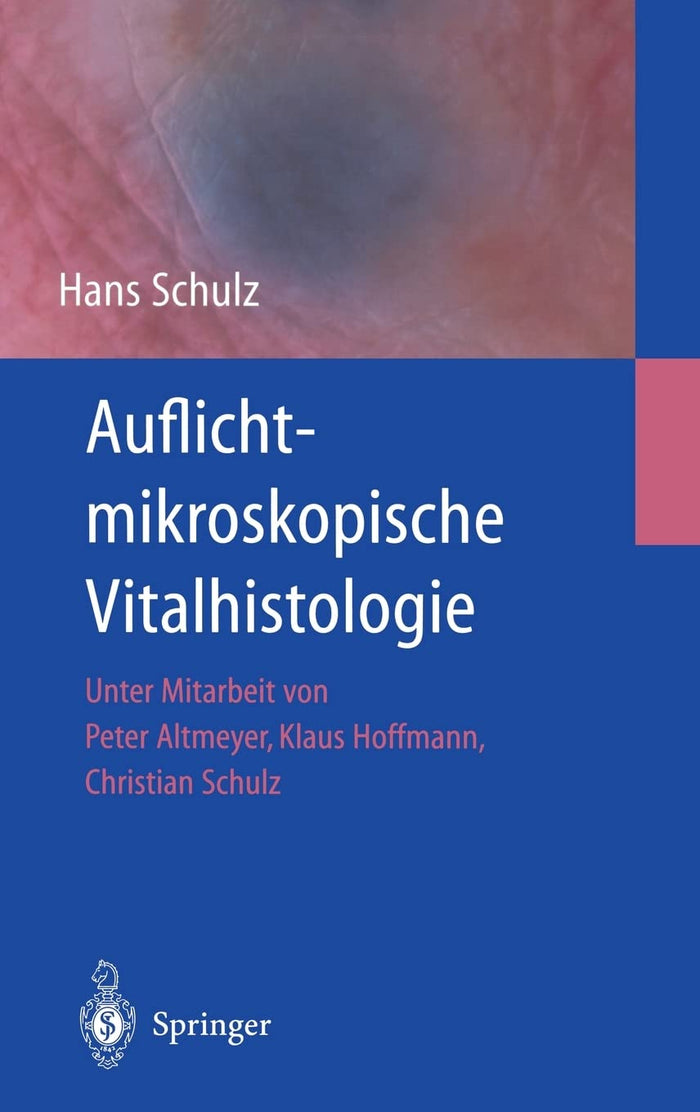 Auflichtmikroskopische Vitalhistologie: Dermatologischer Leitfaden (German Edition)
