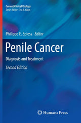 Penile Cancer: Diagnosis and Treatment (Current Clinical Urology)