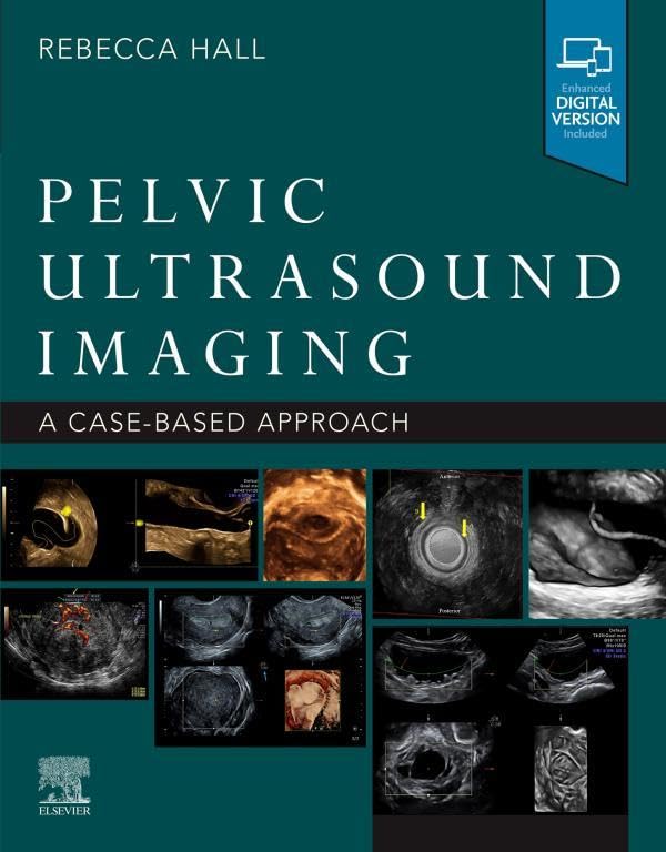 Pelvic Ultrasound Imaging, E-Book: A Cased-Based Application