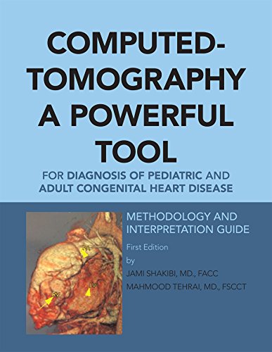 Computed-Tomography a Powerful Tool for Diagnosis of Pediatric and Adult Congenital Heart Disease: Methodology and Interpretation Guide